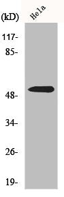 Western Blot analysis of Hela cells using Parkin Polyclonal Antibody