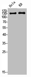 Western Blot analysis of HELA KB cells using PDGFR-β Polyclonal Antibody