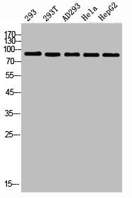 PIK3R1 Antibody – Figure 1 of 1