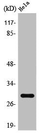 Western Blot analysis of A549 cells using Rab 20 Polyclonal Antibody
