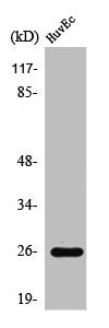 Western Blot analysis of COLO205 cells using Rab L2A Polyclonal Antibody