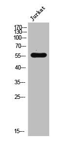 Western Blot analysis of Jurkat cells using Rad18 Polyclonal Antibody