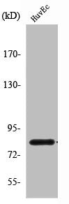Western Blot analysis of HuvEc cells using Radixin Polyclonal Antibody