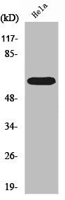 Western Blot analysis of Hela cells using RORα Polyclonal Antibody