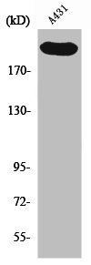 Western Blot analysis of A431 cells using Separase Polyclonal Antibody