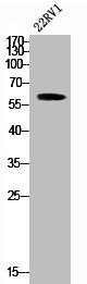 Western Blot analysis of 22RV1 cells using Smad2 Polyclonal Antibody