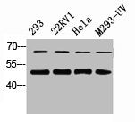 Western Blot analysis of 823 22RV1 HELA 293-UV cells using Smad2/3 Polyclonal Antibody