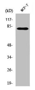 Western Blot analysis of MCF-7 cells using Snk Polyclonal Antibody