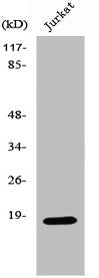 Western Blot analysis of K562 cells using SOD-1 Polyclonal Antibody