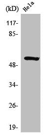 Western Blot analysis of 293 cells using STK33 Polyclonal Antibody