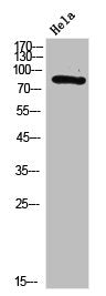 Western Blot analysis of HELA cells using Synapsin I Polyclonal Antibody