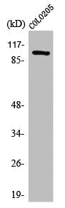 Western Blot analysis of COLO205 cells using Synphilin-1 Polyclonal Antibody