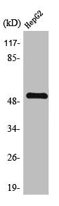 Western Blot analysis of HepG2 cells using TGFβ RI Polyclonal Antibody