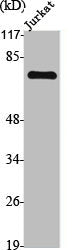 Western Blot analysis of Jurkat cells using TGFβ RII Polyclonal Antibody