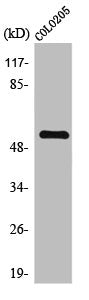 Western Blot analysis of COLO205 cells using TH Polyclonal Antibody