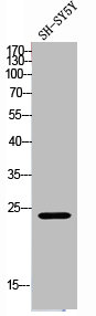 Western Blot analysis of SH-SY5Y cells using TIMP-1 Polyclonal Antibody