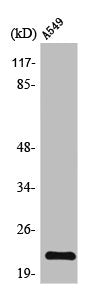 Western Blot analysis of A549 cells using TIMP-2 Polyclonal Antibody