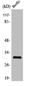 Western Blot analysis of HuvEc cells using TIMP-3 Polyclonal Antibody