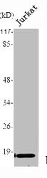 Western Blot analysis of Jurkat cells using TNF-α Polyclonal Antibody