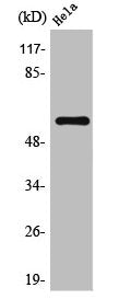 Western Blot analysis of Hela cells using TRAF6 Polyclonal Antibody