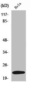 UBE2T Antibody – Figure 1 of 1