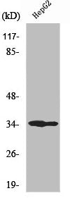 Western Blot analysis of COLO205 cells using UDG Polyclonal Antibody