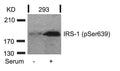Western blot analysis of extracts from 293 cells untreated or treated with serum using IRS-1(Phospho-Ser639) Antibody.