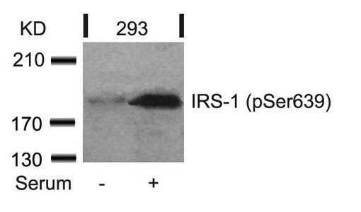 Western blot analysis of extracts from 293 cells untreated or treated with serum using IRS-1(Phospho-Ser639) Antibody.