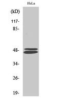 <div align=`left` style=`padding: 0px; margin: 0px; list-style: none;`><font style=`padding: 0px; margin: 0px; list-style: none; line-height: 24px;`>Western Blot analysis of Hela cells using VASP Polyclonal Antibody diluted at 1:500. Secondary antibody was diluted at 1:20000</font></div>