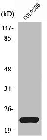 Western Blot analysis of COLO205 cells using VEGI Polyclonal Antibody