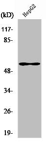 Western Blot analysis of HepG2 cells using VIM Polyclonal Antibody