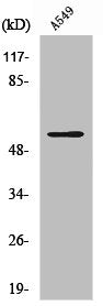 Western Blot analysis of A549 cells using Vimentin Polyclonal Antibody