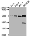Western Blot
Positive WB detected in: Hela whole cell lysate, HepG2 whole cell lysate, MCF-7 whole cell lysate, COLO320 whole cell lysate
All lanes: CALR antibody at 1:2000
Secondary
Goat polyclonal to rabbit IgG at 1/50000 dilution
Predicted band size: 49 kDa
Observed band size: 49 kDa