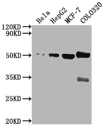 Western Blot
Positive WB detected in: Hela whole cell lysate, HepG2 whole cell lysate, MCF-7 whole cell lysate, COLO320 whole cell lysate
All lanes: CALR antibody at 1:2000
Secondary
Goat polyclonal to rabbit IgG at 1/50000 dilution
Predicted band size: 49 kDa
Observed band size: 49 kDa