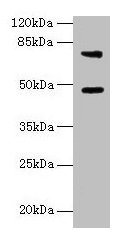 Western blot
All lanes: Casp12 antibody at 6µg/ml + LO2 whole cell lysate
Secondary
Goat polyclonal to rabbit IgG at 1/10000 dilution
Predicted band size: 48 kDa
Observed band size: 48, 75 kDa