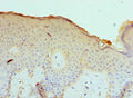 Immunohistochemistry of paraffin-embedded human skin tissue using CSB-PA004546ESR1HU at dilution of 1:100