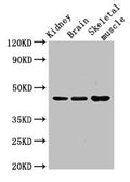 Western Blot
Positive WB detected in: Mouse kidney tissue, Mouse brain tissue, Mouse skeletal muscle tissue
All lanes: CASP4 antibody at 3.5ug/ml
Secondary
Goat polyclonal to rabbit IgG at 1/50000 dilution
Predicted band size: 44, 37, 14, 31, 19 kDa
Observed band size: 44 kDa
