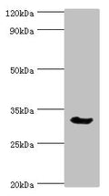 Western blot
All lanes: Caspase-6 antibody at 3ug/ml + Mouse liver tissue
Secondary
Goat polyclonal to rabbit IgG at 1/10000 dilution
Predicted band size: 34, 23 kDa
Observed band size: 34 kDa