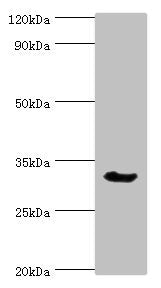 Western blot
All lanes: Caspase-6 antibody at 3ug/ml + Mouse liver tissue
Secondary
Goat polyclonal to rabbit IgG at 1/10000 dilution
Predicted band size: 34, 23 kDa
Observed band size: 34 kDa
