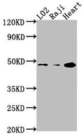 Western Blot
Positive WB detected in: L02 whole cell lysate, Raji whole cell lysate, Mouse heart tissue
All lanes: CASP9 antibody at 1:2000
Secondary
Goat polyclonal to rabbit IgG at 1/50000 dilution
Predicted band size: 47, 31, 18, 37 kDa
Observed band size: 47 kDa