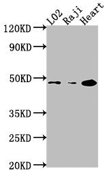 Western Blot
Positive WB detected in: L02 whole cell lysate, Raji whole cell lysate, Mouse heart tissue
All lanes: CASP9 antibody at 1:2000
Secondary
Goat polyclonal to rabbit IgG at 1/50000 dilution
Predicted band size: 47, 31, 18, 37 kDa
Observed band size: 47 kDa