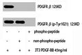 Western Blot analysis of NIH-3T3+PDGF cells using PDGFR-β Polyclonal Antibody