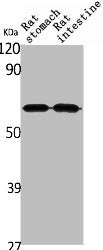 Western Blot analysis of rat stomach rat intestines cells using Angptl1 Polyclonal Antibody