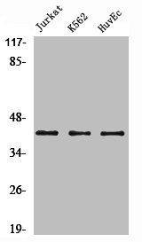 Western Blot analysis of Jurkat K562 HuvEc cells using α-SMA Polyclonal Antibody