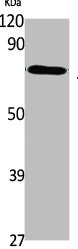 Western Blot analysis of K562 cells using ABCG1 Polyclonal Antibody