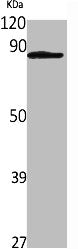 Western Blot analysis of Jurkat cells using IL-31Rα Polyclonal Antibody