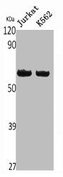 Western Blot analysis of Jurkat K562 cells using Caspase-10 Polyclonal Antibody
