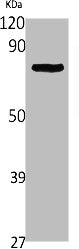 Western Blot analysis of Jurkat cells using NF-L Polyclonal Antibody