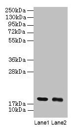 Western blot
All lanes: UBE2I antibody at 2µg/ml
Lane 1: 293T whole cell lysate
Lane 2: EC109 whole cell lysate
Secondary
Goat polyclonal to rabbit IgG at 1/15000 dilution
Predicted band size: 19 kDa
Observed band size: 19 kDa
