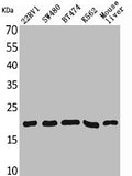 Western Blot analysis of 22RV-1 SW480 BT474 K562 mouse liver cells using VEGF-A Polyclonal Antibody